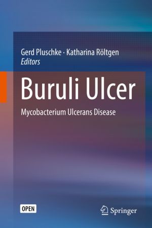 Buruli Ulcer