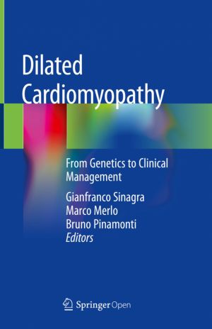 Dilated Cardiomyopathy